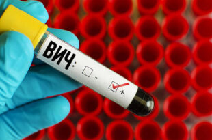 HIV Russia