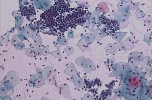 pap test