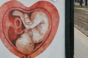 aborto malformazione